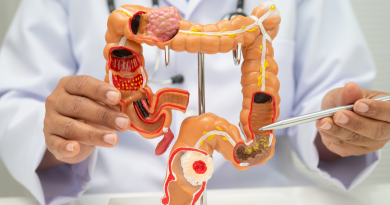 Colon irritabile, quali alimenti evitare e perché possono peggiorare i sintomi